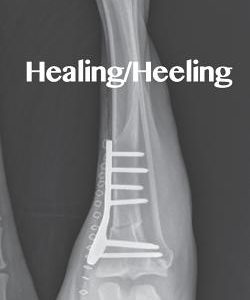 Healing/Heeling